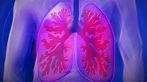 How would i know if i had lung cancer? Know The Early Signs Of Lung Cancer