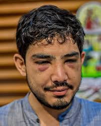 El director de Comunicación, Sebastián Murillo, en conferencia de prensa  denunció que fue víctima de una tentativa de asesinato de grupos delictivos  comandados por Alejandro Unzueta, que busca amedrentar al Gabinete  Municipal,