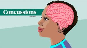 Image result for Concussion