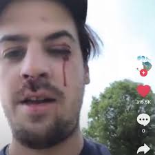 TOP 10 BEST Collision Repair near Candler, NC