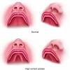 There are so many blood vessels in the areas near the head and neck that even a tiny cut on your little one's lip or tongue can cause a lot of bleeding (which can even make it difficult for you to figure out exactly where all that blood is coming from). Https Encrypted Tbn0 Gstatic Com Images Q Tbn And9gcr9s5rwu9j04srbm1bobil8ufr44rauvepqg9hpr9uoplj Yo79 Usqp Cau