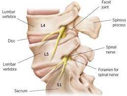 Sciatica Symptoms Diagnosis And Treatments Precision Pain Centre