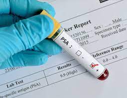 If you receive a diagnosis, your schedule can quickly start to fill up with doctor's appointments, medical procedures and pharmacy visits. The Psa Test And Screening Prostate Cancer Foundation
