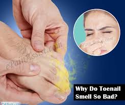 Why Do Toenails Smell So Bad How To Get Rid Of Smelly Toenails