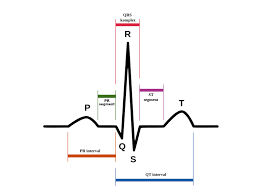 Pin By Christine Morris On Ecg Information Ekg Interpretation Pr Interval Medicine Student