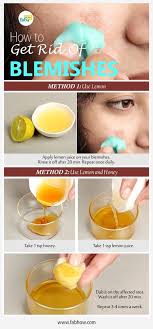 It's acne awareness month, and when it comes to the skin concern, we all want to know: How To Get Rid Of Blemishes Fast Staying Hydrated Is The Key To All Your Skin Troubles Drink A Minimum Of 8 Skin Remedies Acne Remedies Homemade Wrinkle Cream