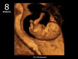 Image result for fetus 7 AND 8 weeks old