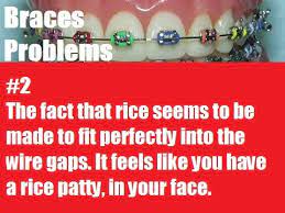 Bracesproblems Braces Problems Braces Humor Braces