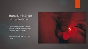 It's hard to tell the cause from your symptoms alone, so go. Pcm 2 Flashcards Quizlet