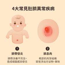 臍帶蛻變成肚臍，公開肚臍清潔與新生兒肚臍流血的原因! - mamaway