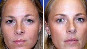 Extremely rare 'Momo' twins who nearly didn't survive birth reveal how  their parents could tell them apart