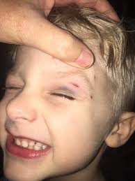 How to stop a 3-month-old Golden Retriever puppy from touching faces with  paws?