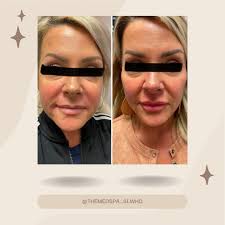 MOTHER'S DAY SPECIAL• Relax & Refresh Facial for Mom- $100 • This facial  will include: •Full 60-minute customized facial tailored to Mom's specific  skin type. •Double Cleanse. •Full Skin Analysis. •Exfoliation. •Extractions  (