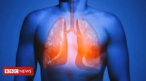 The main symptoms of lung cancer include: Lungs Magically Heal Damage From Smoking Bbc News