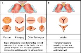 Image result for Umbilicus
