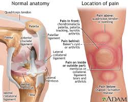 Knee Pain Medlineplus Medical Encyclopedia Image