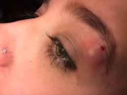 Is Anyone On Here Familiar With Eyebrow Piercing May 2019 Babies Forums What To Expect