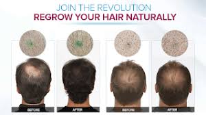 Massage your hair with the mixture from scalp to tip. Olive Oil And Egg Yolk For Thinning And Loss Of Hair