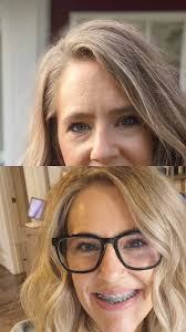 Frownies Facial Patches work wonders. Ridding the forehead area of the face  and the space between the eyes of wrinkles and fine lines. The longevity of  their results builds with continued use.