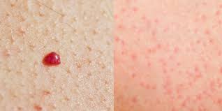 They are also called rashes which can be very painful irritating and itchy. What Do Red Spots On Skin Mean 13 Skin Spots Bumps Pictures