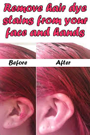 useful ideas on how to remove hair dye