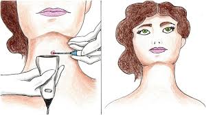 How and When to Treat the Thyroid