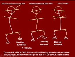 The ligamentum nuchae (ln) is a continuation of the. The Relationship Between The Dental Occlusion Upper Cervical Spine And Temporomandibular Joints Prior To And Following Tens Treatment In Thirty Six Patients Suffering From Temporomandibular Disorder