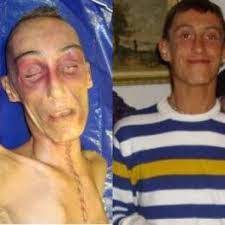 Stefano cucchi è morto il 22 ottobre 2009: Francesco Strazzari On Twitter Everybody Acquitted For Death In Custody Of Stefano Cucchi As Italy S Parliament Seeks To Introduce Crime Of Torture Http T Co Oci13kzyk6