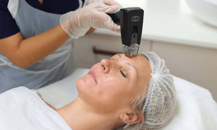 Morpheus8 RF Microneedling Overview at Omniya Clinic
