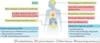 Image result for Multisystem Inflammatory Syndrome