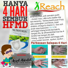 Tulang adalah salah satu jenis jaringan ikat yang dilengkapi sumsum tulang. Cara Merawat Hfmd Tanpa Ubat Ladywankaydiary Com