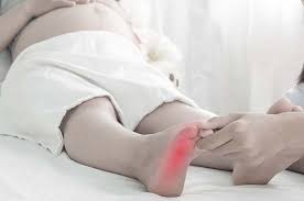 Sapukan dua kali sehari, gosokkan dengan pergerakan memijat. Kaki Bengkak Saat Hamil Bolehkah Berolahraga