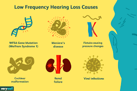 Definition And Causes Of Low Frequency Hearing Loss