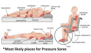 Image result for Comprehensive Skin Integrity Assessment