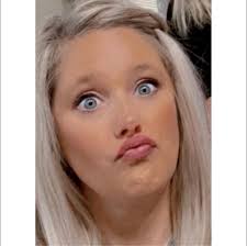 Hit and run accident