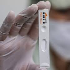 Michael schnedlitz von der fpö testet seine cola live am rednerpult auf corona und das ergebnis ist positiv. Coronavirus Was Bringen Schnelltests Ndr De Nachrichten Mecklenburg Vorpommern