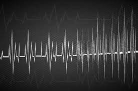 La fecha y la hora reflejan el momento en que el terremoto occurrió. Temblor En Chile Hoy 23 De Enero Latinoamerica Internacional Eltiempo Com