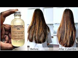 Almond oil nourishes the hair body and promotes hair growth by strengthening its roots and tired of fighting eczema and itching, make almond oil your ally and you do not need anything else. Most People Don T Know How To Use Castor Oil Correctly Youtube Castor Oil For Hair Castor Oil For Hair Growth Castor Oil For Skin