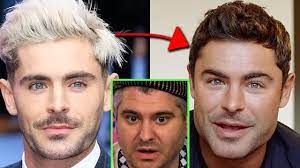 As viewers zoomed in on his face. Zac Efron S Plastic Surgery Youtube
