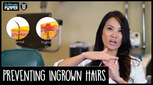 According to mayo clinic, there is a really easy ingrown hair remedy; Preventing Ingrown Hairs Pop Quiz Youtube