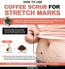 Using an exfoliating scrub rich in coffee, coconut oil and raw sugar has many health benefits to your skin such as: How To Remove Stretch Marks Fast With Coffee Scrub