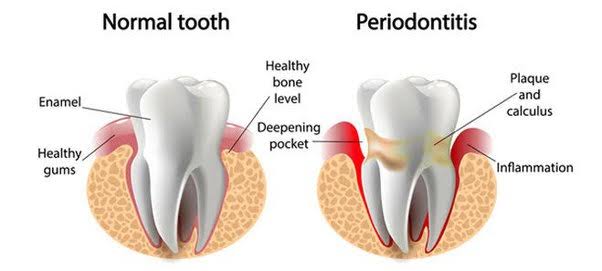 Periodontist product image