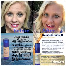 What products or treatments can soften forehead lines and frown lines?