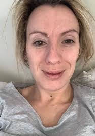 Aberdeen mum-of-three with Long Covid left using wheelchair and crutches