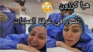 ظهور الندبات أو التشوّهات، وعدم اختفاء آثار العملية في بعض الأحيان، الأمر الذي. Ù‡ÙŠØ§ ÙƒØ±Ø²ÙˆÙ† ØªØµÙˆØ± Ù†ÙØ³Ù‡Ø§ Ø£Ø«Ù†Ø§Ø¡ Ø¹Ù…Ù„ÙŠØ© ØªØ¬Ù…ÙŠÙ„ Ù„Ø§ ÙŠÙÙˆØªÙƒÙ… Youtube