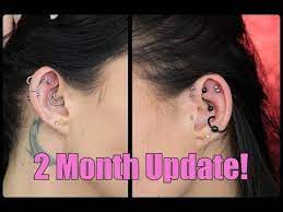 Helix Piercings 2 Month Update Massive Keloids Youtube