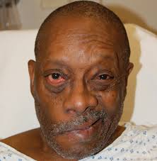 Differentiating Facial Weakness Caused By Bell S Palsy Vs Acute Stroke Jems