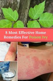 Poison Ivy Home Remedies 8 Most Effective Remedies For Poison Ivy Poison Ivy Home Remedies Poison Ivy Remedies Home Remedies