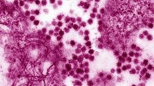 West nile virus (wnv) is most commonly transmitted to humans by mosquitoes. Roofvogel Ziektes Westnijlvirus Wnv