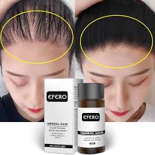 Increases scalp blood flow — enhanced blood circulation makes hair follicles receive more nutrients, minerals, and oxygen necessary for hair growth. Efero Hot Hair Loss Treatment Serum Anti Hair Loss Serum Essential Oils Dense Hair Growth Serum Hair Care Prevent Baldness Tslm1 Men S Hair Loss Products Aliexpress